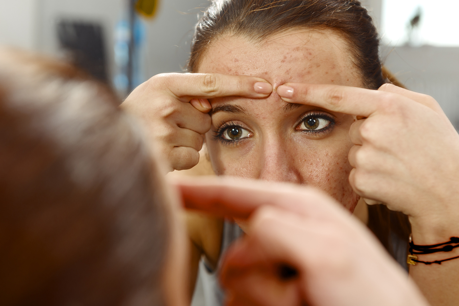 face acneic problems